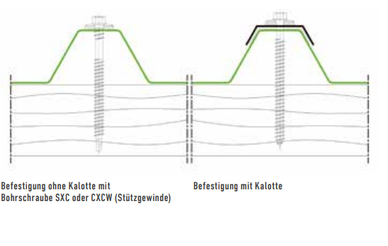 VERSCHRAUBUNG IM OBERGURT (SONDER-VERSCHRAUBUNG)